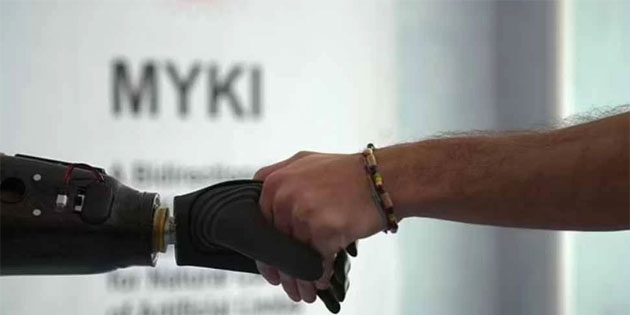 Gney Kbrs’ta sol elini kaybeden hastaya biyonik el takld