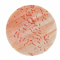 7 ki�ide Almanya ile ba�lant�l� E. Coli 