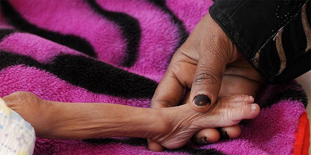 AB'den Yemen'e acil insani yardm ars