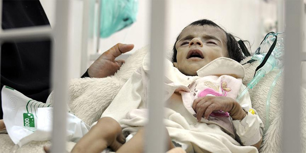 Yemen'de yarm milyon ocuk lm tehlikesiyle kar karya