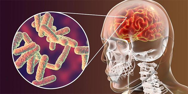 17 ya��ndaki gen� menenjitten hayat�n� kaybetti 