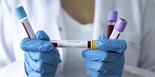 G�ney K�br�s'ta haftal�k koronavir�s rakamlar� a��kland�