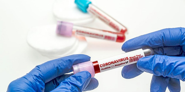 SON 24 SAATTE 94 VAKA 