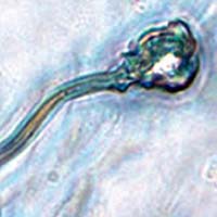 Tp dnyasnda byk gelime: nsan derisinden sperm