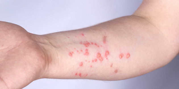 Di� Tabipleri Odas�'ndan �yelerine maymun �i�e�i hastal��� konusunda uyar�lar