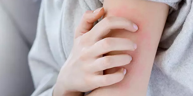 Atat�rk �lkokulu'ndaki uyuz vakalar�