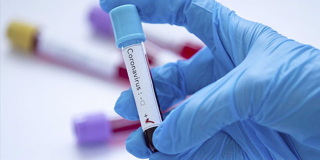 COVD BR CAN DAHA ALDI 