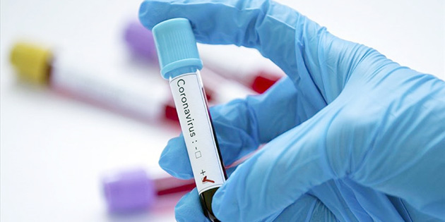 G�NEY KIBRIS’TA 10 YEN� KORONAV�R�S VAKASI