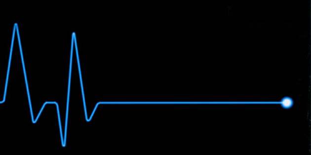 51 ya��ndaki Mehmet Beri�bek’in �l�m nedeni belli oldu