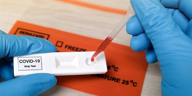 KKTC'de 72 gndr koronavirs vakas yok 