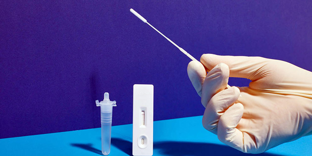 TEMASLILARA PCR CRET ALINMIYOR 