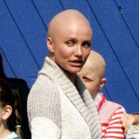 Cameron Diaz kafay kazd  